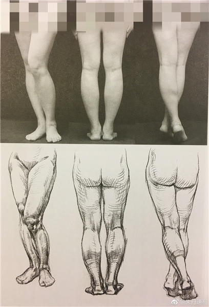 不同角度腿部照片与结构草图的比较